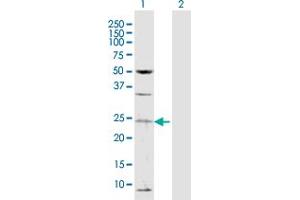 Western Blot analysis of TAF13 expression in transfected 293T cell line by TAF13 MaxPab polyclonal antibody. (TAF13 antibody  (AA 1-124))