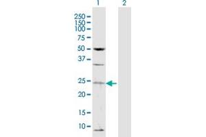 TAF13 antibody  (AA 1-124)