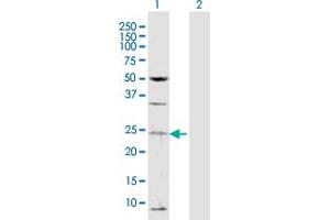 Western Blot analysis of TAF13 expression in transfected 293T cell line by TAF13 MaxPab polyclonal antibody.