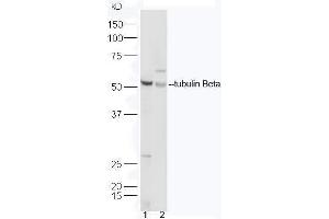 Lane 1:Mouse heart lysates; Lane 2: Human MCF7 cell lysates probed with Rabbit Anti-Tubulin Beta Polyclonal Antibody, Unconjugated  at 1:5000 for 90 min at 37˚C. (TUBB antibody  (AA 61-160))