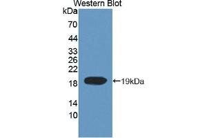 Detection of Recombinant TOP3, Human using Polyclonal Antibody to Topoisomerase III (TOP3) (TOP3 antibody  (AA 35-179))