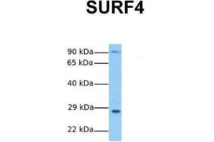 Host:  Rabbit  Target Name:  SURF4  Sample Tissue:  Human Stomach Tumor  Antibody Dilution:  1. (Surfeit 4 antibody  (N-Term))