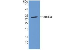 Detection of Recombinant SOD4, Human using Polyclonal Antibody to Superoxide Dismutase Copper Chaperone (Superoxide dismutase copper chaperone antibody  (AA 23-269))