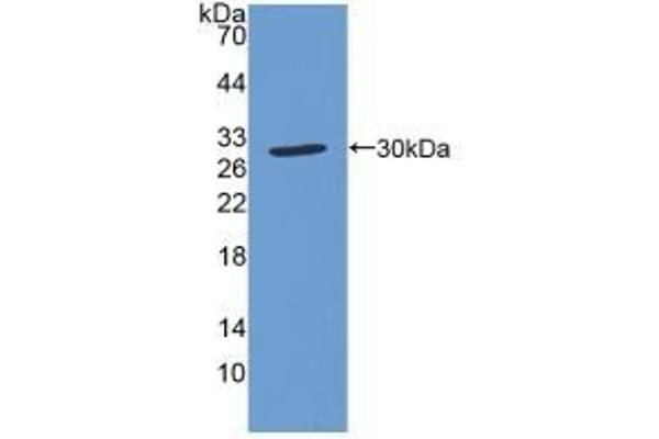 Superoxide dismutase copper chaperone antibody  (AA 23-269)