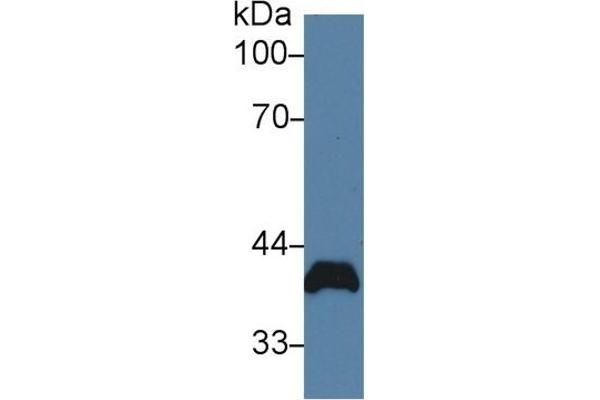 Poliovirus Receptor antibody  (AA 22-255)