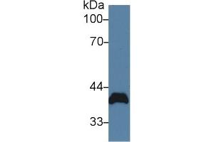 Detection of PVR in Rat Heart lysate using Polyclonal Antibody to Poliovirus Receptor (PVR) (Poliovirus Receptor antibody  (AA 22-255))