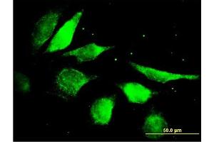 Immunofluorescence of purified MaxPab antibody to FGF5 on HeLa cell.