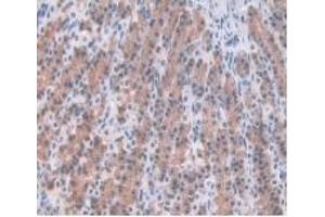 Detection of a1AGP in Rat Stomach Tissue using Monoclonal Antibody to Alpha-1-Acid Glycoprotein (a1AGP) (ORM1 antibody  (AA 19-186))