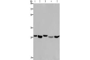 Western Blotting (WB) image for anti-Enoyl CoA Hydratase, Short Chain, 1, Mitochondrial (ECHS1) antibody (ABIN2423345) (ECHS1 antibody)