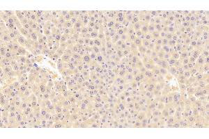 Detection of ROR1 in Mouse Liver Tissue using Polyclonal Antibody to Receptor Tyrosine Kinase Like Orphan Receptor 1 (ROR1) (ROR1 antibody  (AA 470-707))