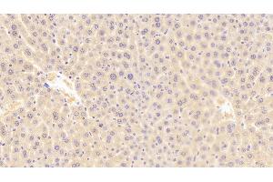 Detection of ROR1 in Mouse Liver Tissue using Polyclonal Antibody to Receptor Tyrosine Kinase Like Orphan Receptor 1 (ROR1) (ROR1 antibody  (AA 470-707))