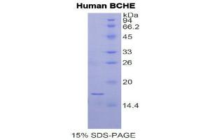 SDS-PAGE (SDS) image for Butyrylcholinesterase (BCHE) (AA 29-150) protein (His tag) (ABIN1525364) (Butyrylcholinesterase Protein (BCHE) (AA 29-150) (His tag))