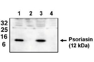 Image no. 1 for anti-S100 Calcium Binding Protein A7 (S100A7) antibody (ABIN264929) (S100A7 antibody)