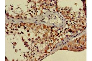 Immunohistochemistry of paraffin-embedded human testis tissue using ABIN7169274 at dilution of 1:100 (PPP2R3A antibody  (Regulatory Subunit B))