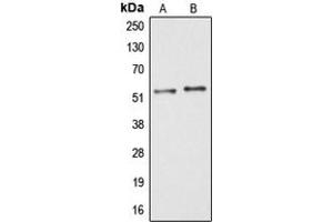 Western blot analysis of ARMC6 expression in HT29 (A), COLO205 (B) whole cell lysates. (ARMC6 antibody  (C-Term))