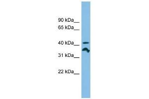 RRAGC antibody used at 1 ug/ml to detect target protein.