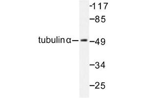 Image no. 1 for anti-Tubulin, alpha 1B (TUBA1B) antibody (ABIN272103) (TUBA1B antibody)