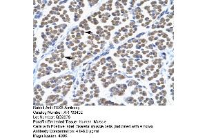 Immunohistochemistry (IHC) image for anti-T-Box 5 (TBX5) (Middle Region) antibody (ABIN2777914) (T-Box 5 antibody  (Middle Region))