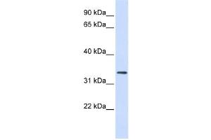 Western Blotting (WB) image for anti-F-Box Protein 25 (FBXO25) antibody (ABIN2458708) (FBXO25 antibody)