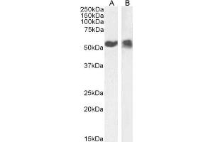 Western Blot using anti-p53 antibody PAb42. (Recombinant p53 antibody  (AA 371-380))