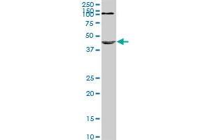 NODAL monoclonal antibody (M03), clone 5C3. (Nodal antibody  (AA 275-346))