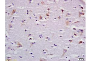 Formalin-fixed and paraffin embedded rat brain labeled with Anti-BBS9 Polyclonal Antibody, Unconjugated (ABIN1387812) at 1:200 followed by conjugation to the secondary antibody and DAB staining (BBS9 antibody  (AA 244-320))
