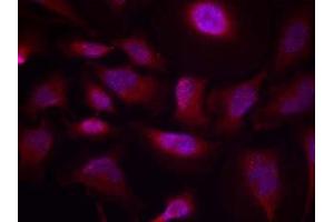 Immunofluorescence staining of methanol-fixed HeLa cells using ATF-2 (phospho-Thr73 or 55) antibody (E011032, Red) (ATF2 antibody  (pThr55, pThr73))
