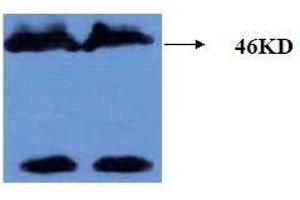 Western Blotting (WB) image for anti-Microtubule-Associated Protein tau (MAPT) (AA 177-187), (pThr181) antibody (ABIN1108152) (MAPT antibody  (pThr181))