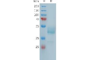 Human F(752-834) Protein, mFc Tag on SDS-PAGE under reducing condition.