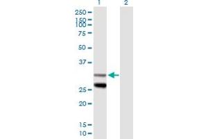 Western Blot analysis of SCO1 expression in transfected 293T cell line by SCO1 MaxPab polyclonal antibody. (SCO1 antibody  (AA 1-301))