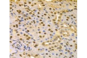 Immunohistochemistry of paraffin-embedded Rat kidney using COPS5 Polyclonal Antibody at dilution of 1:100 (40x lens). (COPS5 antibody)