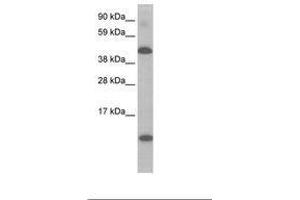 Image no. 1 for anti-Ligand Dependent Nuclear Receptor Corepressor (Lcor) (N-Term) antibody (ABIN6736069) (Lcor antibody  (N-Term))