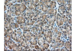 Immunohistochemical staining of paraffin-embedded Human liver tissue using anti-PDE4A mouse monoclonal antibody. (PDE4A antibody)