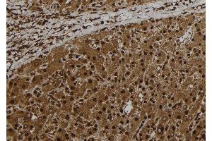 ABIN6278751 at 1/100 staining Human liver tissue by IHC-P. (CT47A1 antibody)