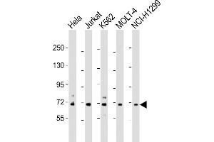 All lanes : Anti-NUP85 Antibody (N-Term) at 1:2000 dilution Lane 1: Hela whole cell lysate Lane 2: Jurkat whole cell lysate Lane 3: K562 whole cell lysate Lane 4: MOLT-4 whole cell lysate Lane 5: NCI- whole cell lysate Lysates/proteins at 20 μg per lane.