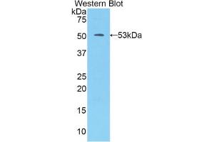 Western blot analysis of the recombinant protein. (Kallikrein 7 antibody  (AA 23-253))