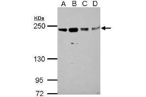 WB Image Sample (30 ug of whole cell lysate) A: A549 B: H1299 C: HCT116 D: MCF-7 5% SDS PAGE antibody diluted at 1:1000 (SLK antibody)