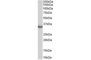Image no. 1 for anti-STIP1 Homology and U-Box Containing Protein 1 (STUB1) (C-Term) antibody (ABIN374173) (STUB1 antibody  (C-Term))
