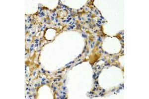 Immunohistochemistry of paraffin-embedded rat lung using IL9 antibody (ABIN3015677, ABIN3015678, ABIN1680463 and ABIN6219030) at dilution of 1:200 (40x lens). (IL-9 antibody  (AA 19-144))
