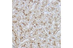 Immunohistochemistry of paraffin-embedded human liver using L Rabbit pAb (ABIN6129969, ABIN6143081, ABIN6143082 and ABIN6218224) at dilution of 1:200 (40x lens). (LAMP2 antibody  (AA 30-300))