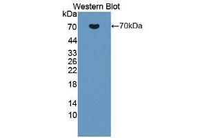 Western blot analysis of the recombinant protein. (TJP1 antibody  (AA 23-502))