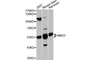 Western blot analysis of extracts of various cell lines, using MBD2 antibody.