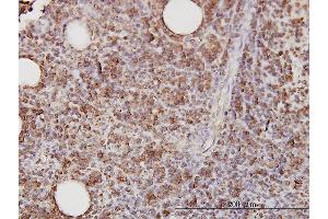 Immunostaining (ISt) image for anti-CD58 (CD58) (AA 1-240) antibody (ABIN560255)