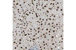 Immunohistochemical staining of human liver with USP36 polyclonal antibody  shows strong nuclear positivity in hepatocytes at 1:20-1:50 dilution.