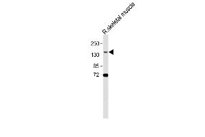 Anti-BCORL1 Antibody (N-term) at 1:500 dilution + Rat skeletal muscle lysate Lysates/proteins at 20 μg per lane. (BCORL1 antibody  (N-Term))