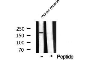 Western blot analysis on mouse muscle lysate using TOP2A Antibody (Topoisomerase II alpha antibody  (Internal Region))