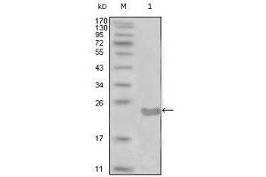 Western blot analysis using CD10 mouse mAb against truncated CD10-His recombinant protein (1). (MME antibody)