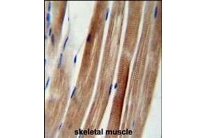 KI Antibody (Center) (ABIN654704 and ABIN2844396) immunohistochemistry analysis in formalin fixed and paraffin embedded human skeletal muscle followed by peroxidase conjugation of the secondary antibody and DAB staining. (KANSL3 antibody  (AA 398-427))