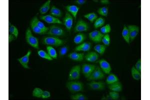 Immunofluorescence staining of Hela cells with ABIN7158919 at 1:166, counter-stained with DAPI. (MFSD4 antibody  (AA 160-220))