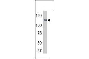 The USP25 polyclonal antibody  is used in Western blot to detect USP25-transfected HeLa cell lysates . (USP25 antibody  (C-Term))